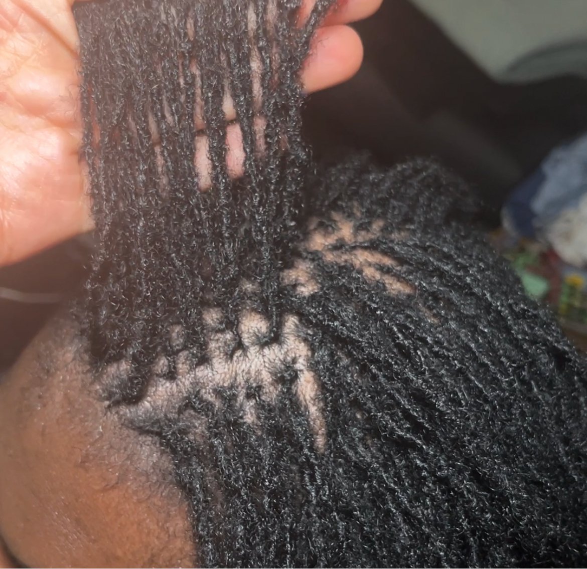 Microlocks Resserrage Paris et en Île de France - Auliviha