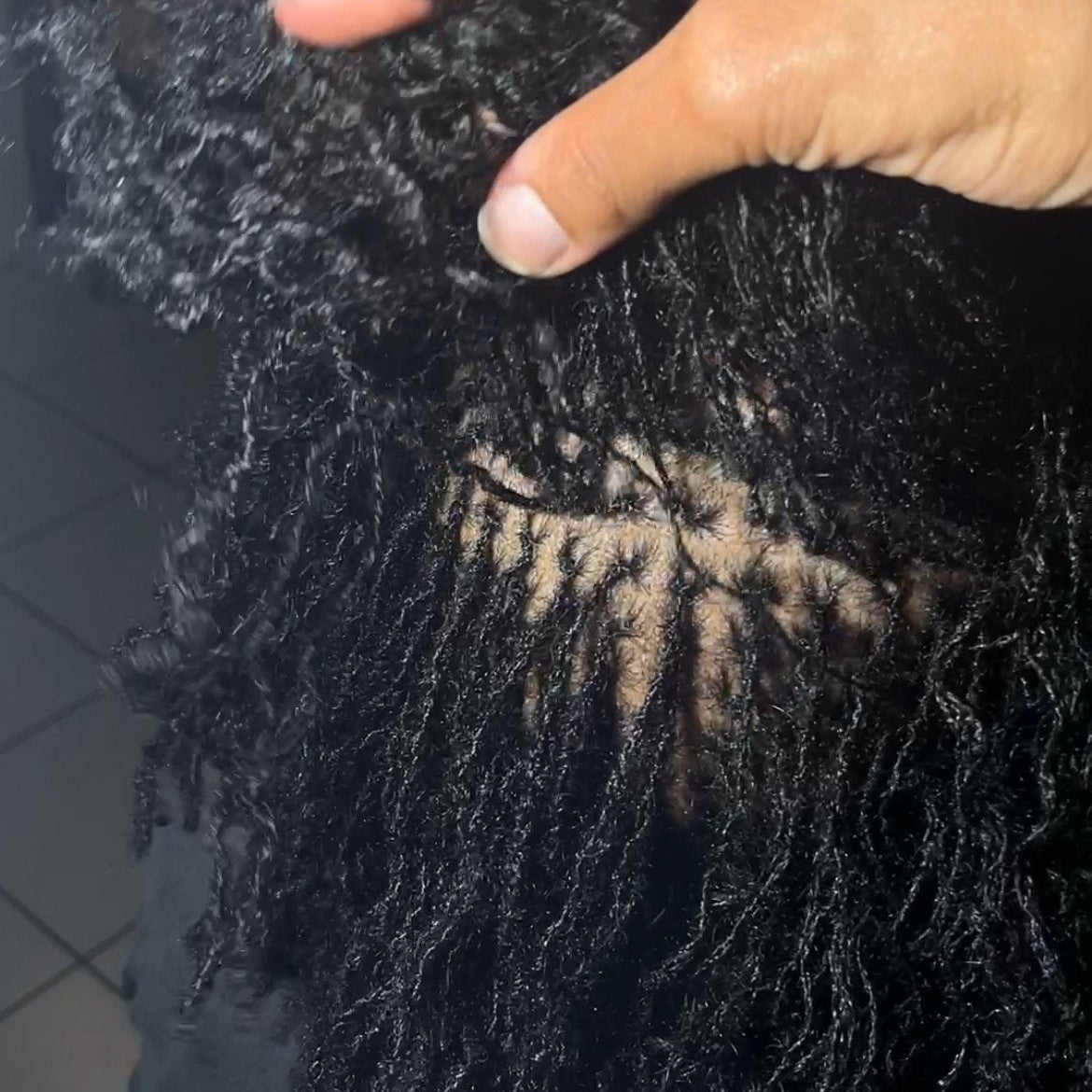 Resserrage de Microlocks en France - Auliviha