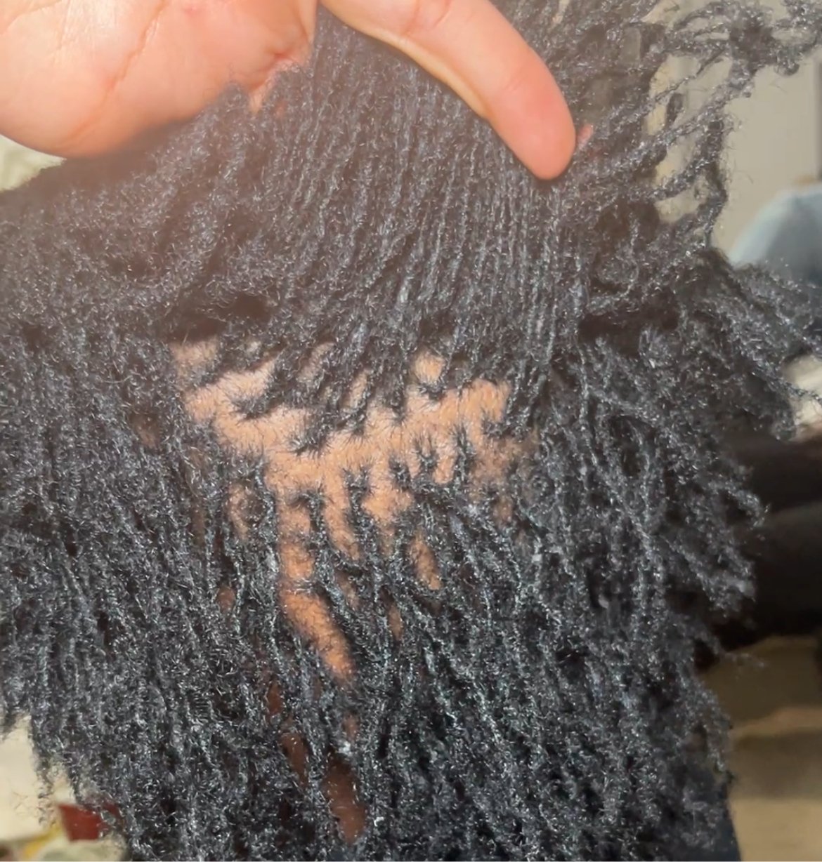 Resserrage de Microlocks à domicile - Auliviha