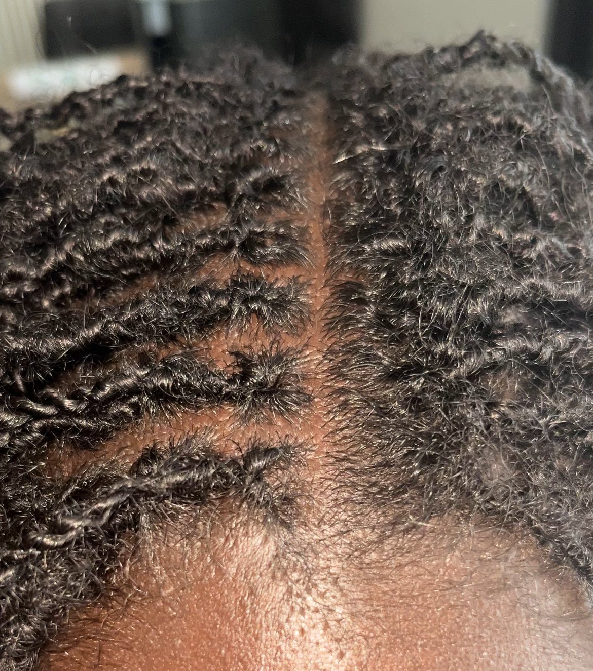 Resserrage de Microlocks en Île - de - France et dans l'Oise - Auliviha